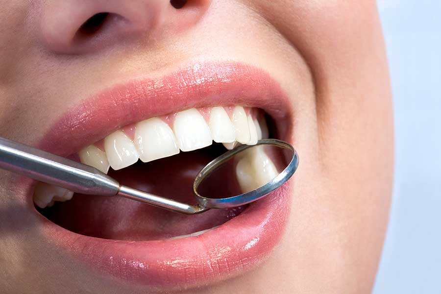woman with mouth open getting an oral checkup at the dentist